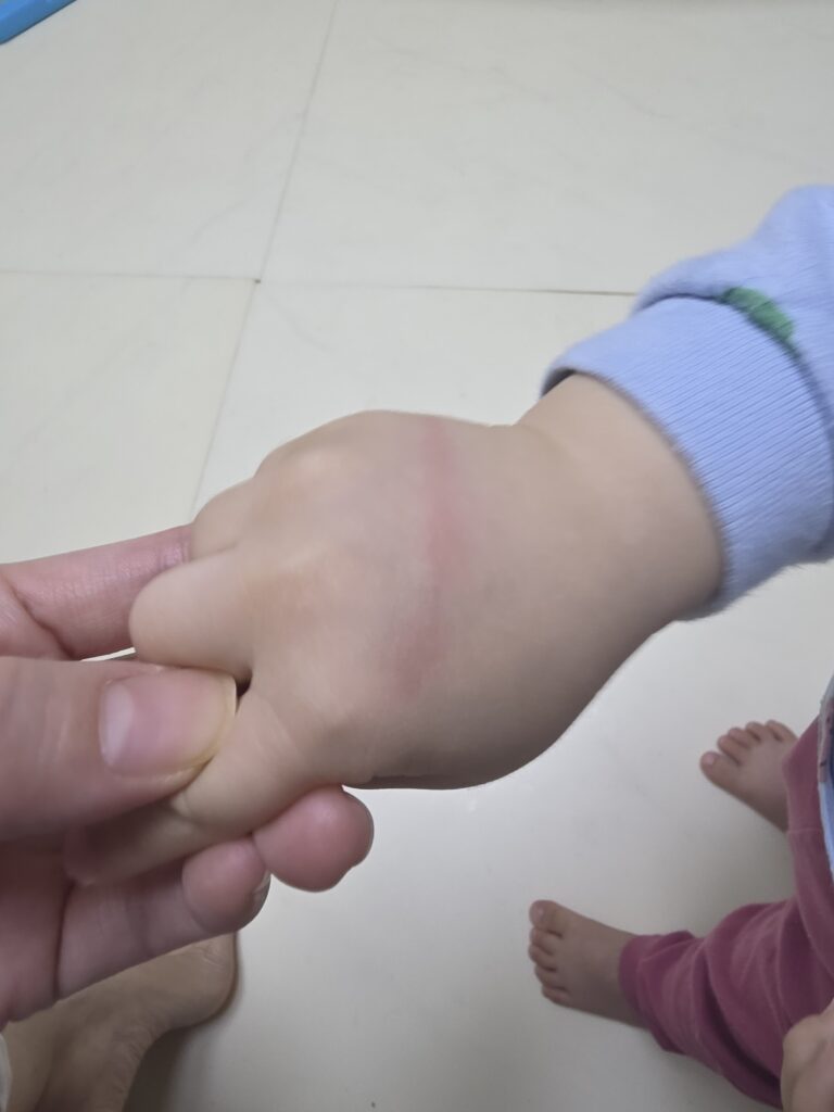 아기문손끼임 사고