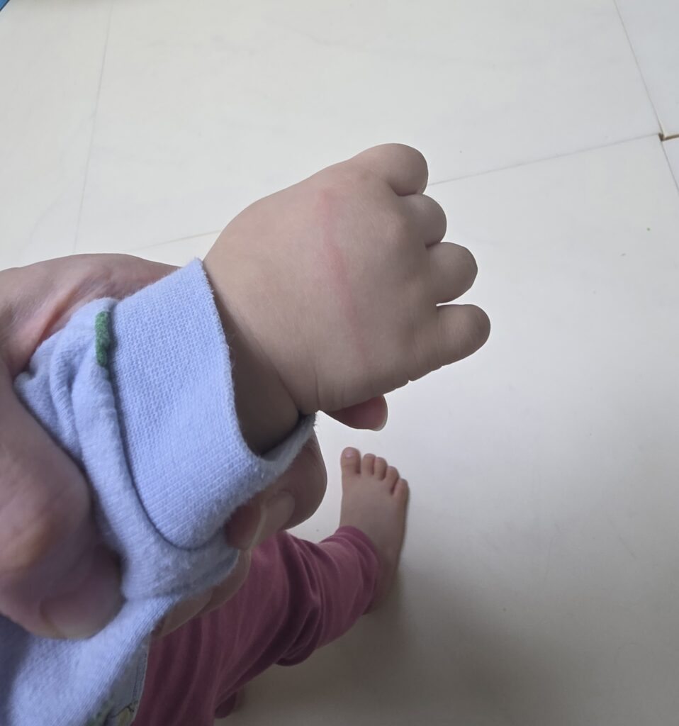 아기문손끼임 체크리스트