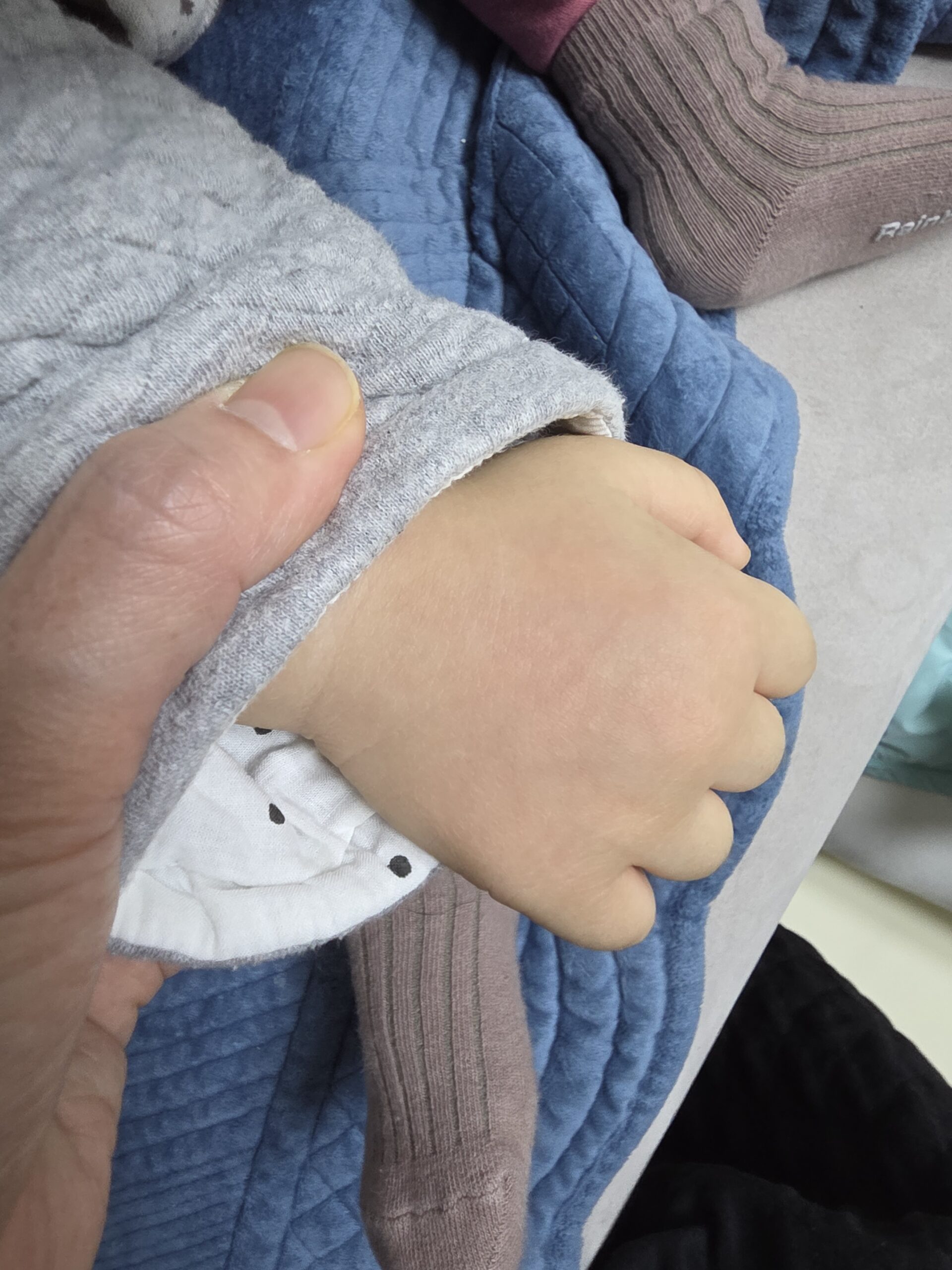 아기손끼임정형외과 방문 엑스레이 촬영은 못한 이유